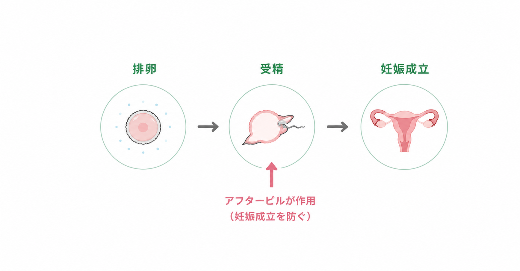 排卵、受精、妊娠成立と、アフターピルが作用するタイミングの説明図